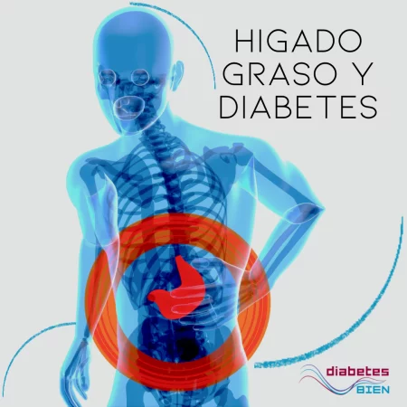 HigadoGraso-DiabetesBien